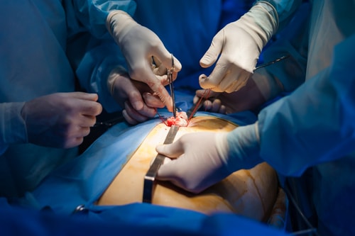 Cirugias Ginecologicas y Obstetricas